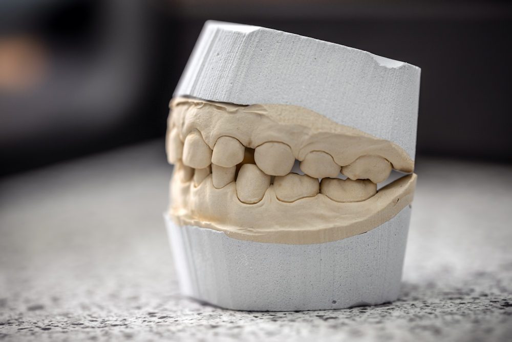 Pediatric patient at Rose Dental Group & Orthodontics